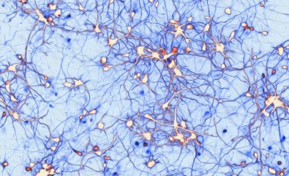 Dr Anggono’s winning entry shows neurons extending their axons to establish synaptic connections. Dr Anggono’s winning entry shows neurons extending their axons to establish synaptic connections.